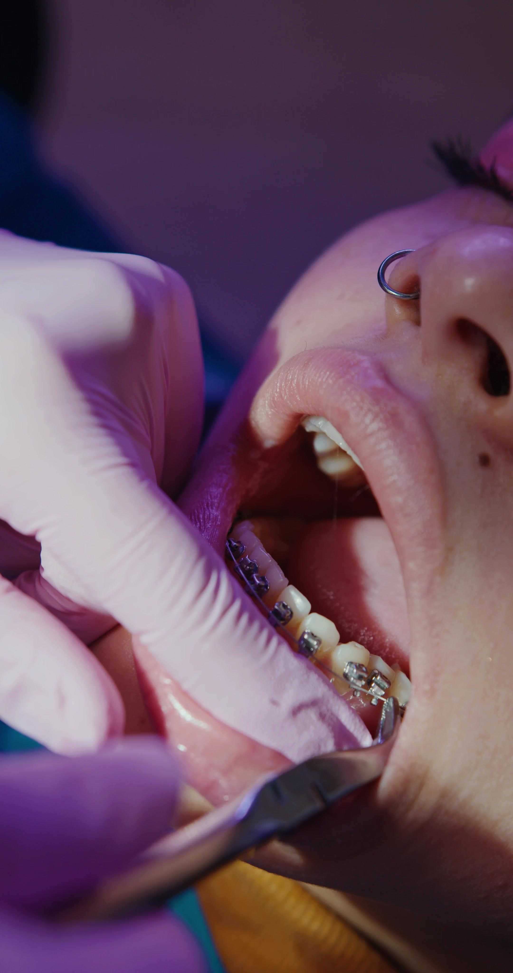 Smiling patient at SOMA Dental and Aesthetic Clinic